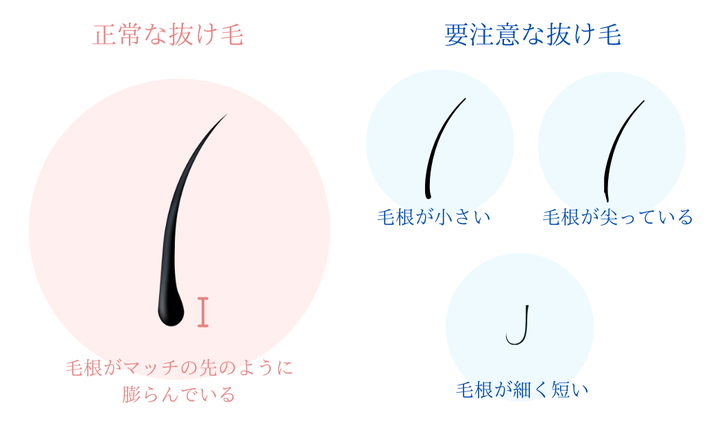 MIRAI法の図解画像