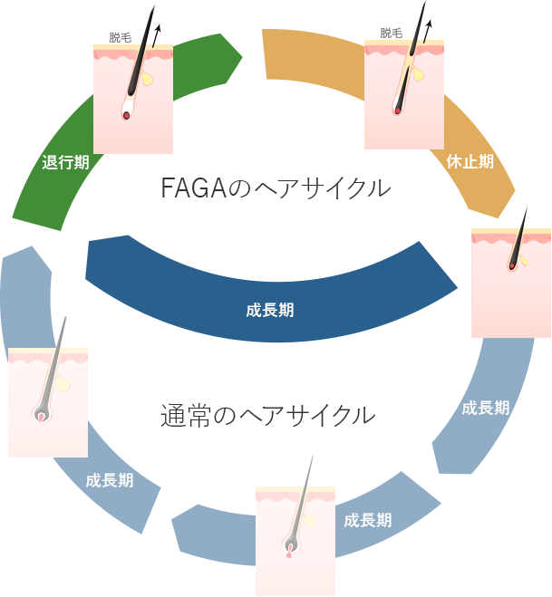 FAGAのメカニズム