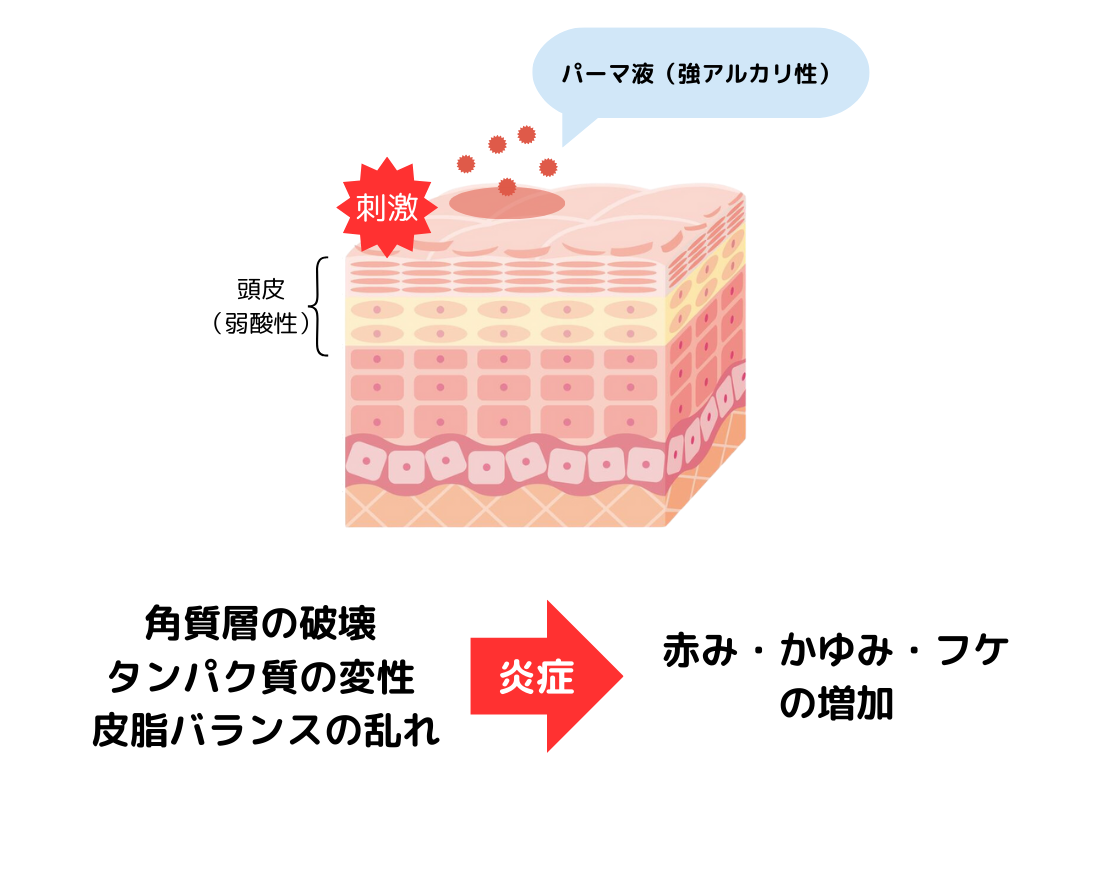 パーマによる頭皮へのダメージ