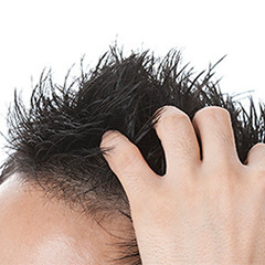 自毛植毛後の髪の寿命はどのくらいですか 親和クリニックのドクターが自毛植毛の疑問を解決