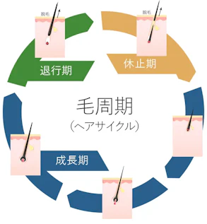 AGA治療で後悔するのはなぜ？